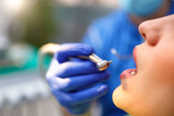 Dental Bonding in Oreana, IL
